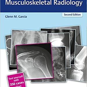 RadCases Q&A Musculoskeletal Radiology (Radcases Plus Q&A) 2nd Edition Second ed 2e