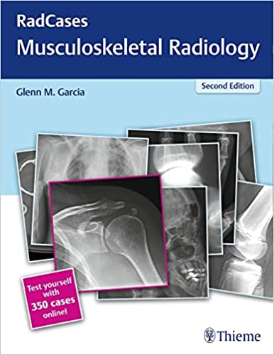 RadCases Q&A Musculoskeletal Radiology (Radcases Plus Q&A) 2nd Edition Second ed 2e