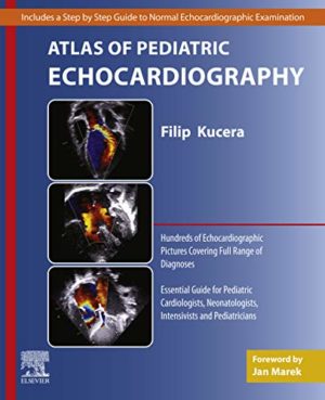 Atlas of Pediatric Echocardiography 1st Edition