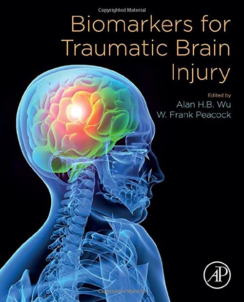 創傷性腦損傷的生物標誌物，作者：Alan HB Wu，W. Frank Peacock MD