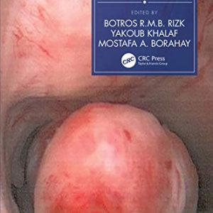 Fibroids and Reproduction 1st Edition