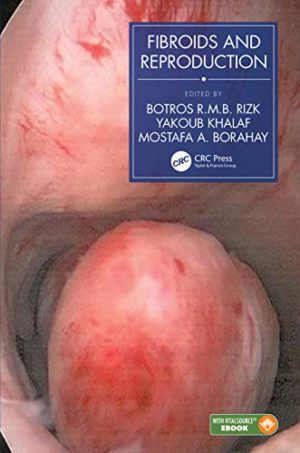 Fibroids and Reproduction 1st Edition