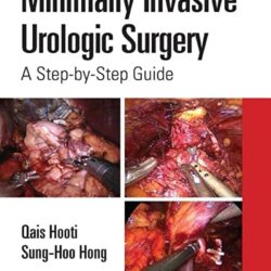 Cirurgia Urológica Minimamente Invasiva: Um Guia Passo a Passo 1ª Edição