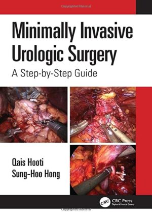 Minimally Invasive Urologic Surgery: A Step-by-Step Guide 1st Edition