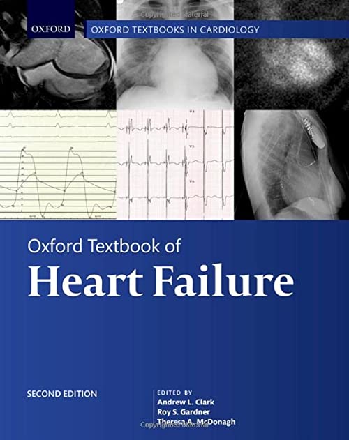 Oxford Textbook of Heart Failure 2nd Edition