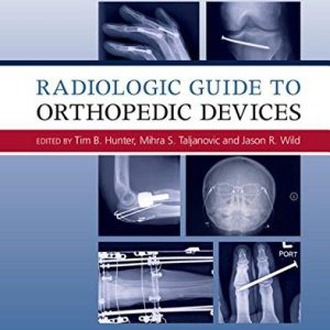 Radiologic Guide to Orthopedic Devices