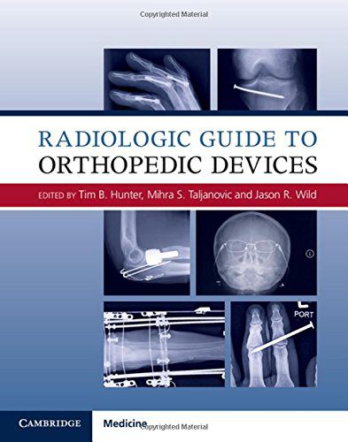 Радіологічний посібник з ортопедичних пристроїв