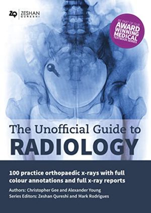 The Unofficial Guide to Radiology : 100 Practice Orthopaedic X Rays 2nd Edition