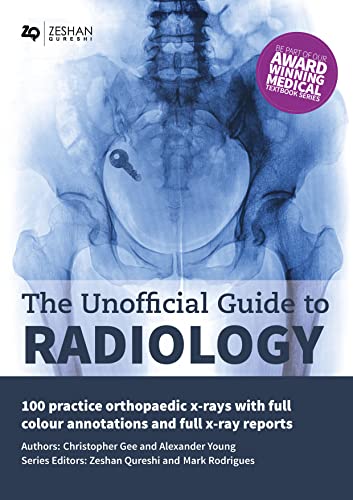 Неофициальное руководство по радиологии: 100 практических ортопедических рентгеновских лучей, 2-е издание
