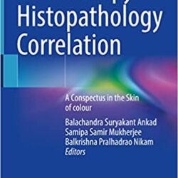 Dermoscopia - Correlazione istopatologia: un Conspectus nella pelle del colore