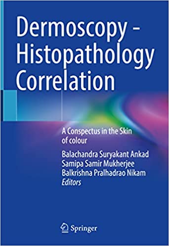 Dermoscopie - Histopathologiecorrelatie: een conspectus in de huid van kleur