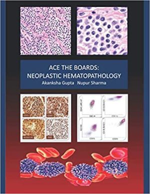 Ace the Boards: Neoplastic Hematopathology (Ace My Path)
