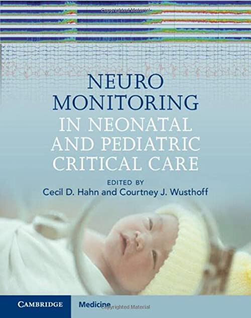 Neuromonitoring in Neonatal and Pediatric Critical Care 1st Edition