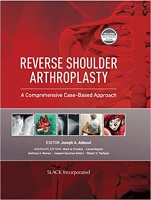 Reverse Shoulder Arthroplasty: A Comprehensive Case-Based Approach