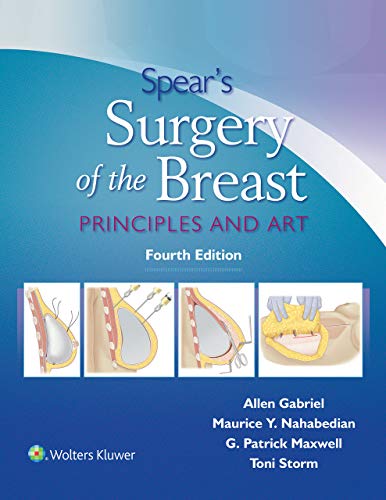 Cirurgia da Mama de Spear: Princípios e Arte 4ª Edição