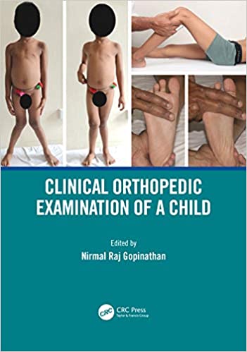Exame Clínico Ortopédico de Criança 1ª Edição