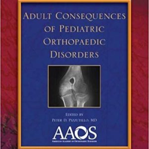 Adult Consequences of Pediatric Orthopaedic Disorders