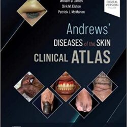 Клинический атлас кожных заболеваний Эндрюса, 2-е издание