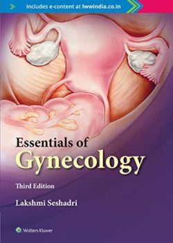 Essentials of Gynaecology, 3e