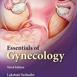 Essentials of Gynaecology, 3e