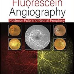 Practical Handbook of Fluorescein Angiography: Posterior Pole and Retinal Periphery 2nd Edition