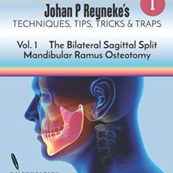 Techniques, trucs, astuces et pièges de Johan P Reyneke : Volume 1