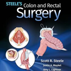 Steele's Colon and Rectal Surgery Primeira Edição por Scott Steele (Editor)