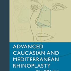 PDF Advanced Caucasian and Mediterranean Rhinoplasty