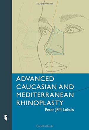 Advanced Caucasian and Mediterranean Rhinoplasty