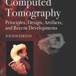 Tomografía computarizada: principios, diseño, artefactos y avances recientes, 4.ª edición