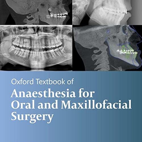 Oxford Textbook of Anaesthesia for Oral and Maxillofacial Surgery, Second Edition 2nd Edition