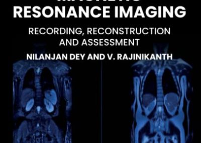 Magnetic Resonance Imaging: Recording, Reconstruction and Assessment (Primers in Biomedical Imaging Devices and Systems) 1st Edition by Rajinikanth V. (Author), Nilanjan Dey (Author)