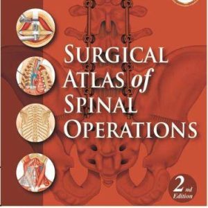 Surgical Atlas of Spinal Operations, 2nd Edition