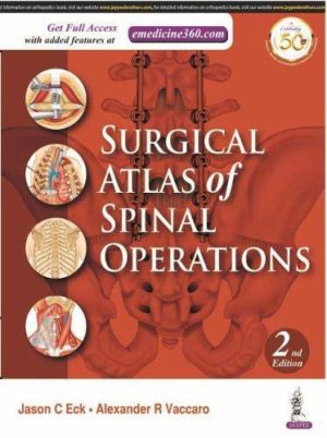 Surgical Atlas of Spinal Operations, 2nd Edition