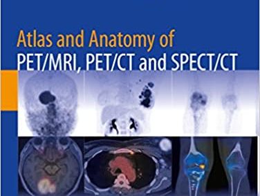Atlas and Anatomy of PET/MRI, PET/CT and SPECT/CT, 2nd Edition