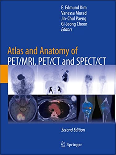 Atlas and Anatomy of PET/MRI, PET/CT and SPECT/CT, 2nd Edition