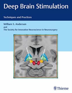 Deep Brain Stimulation: Techniques and Practices 1st Edition
