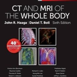 CT and MRI of the Whole Body, 2-Volume Set (Computed Tomography & Magnetic Resonance Imaging Of The Whole Body E-Book), 6th Edition - Original PDF