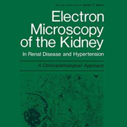 Electron Microscopy of the Kidney: In Renal Disease and Hypertension: A Clinicopathological Approach