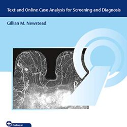 Breast MRI Interpretation Text and Case Analysis for Screening and Diagnosis Gillian M. Newstead