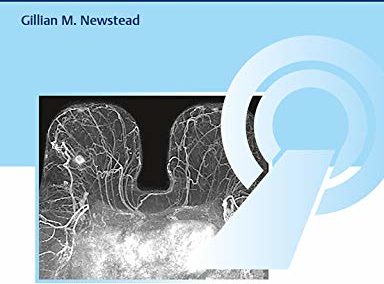 Breast MRI Interpretation: Text and Case Analysis for Screening and Diagnosis 1st Edition