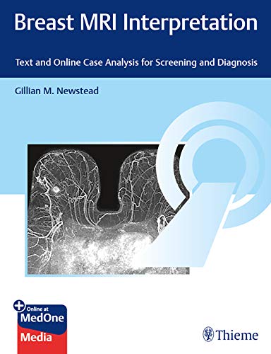 Breast MRI Interpretation Text and Case Analysis for Screening and Diagnosis Gillian M. Newstead