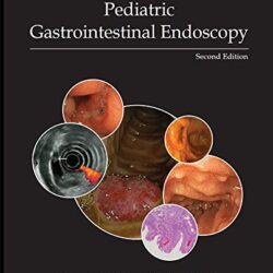 Pediatric Gastrointestinal Endoscopy 2nd Edition