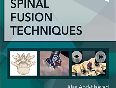 Spinal Fusion Techniques 1st Edition