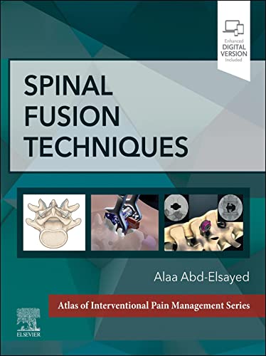 Spinal Fusion Techniques – 1st edition(Original PDF)