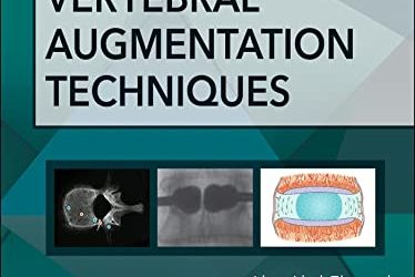 Vertebral Augmentation Techniques (Atlas of Interventional Pain Management) 1st Edition