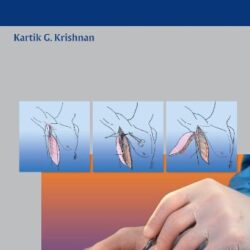 An Illustrated Handbook of Flap-Raising Techniques ✓