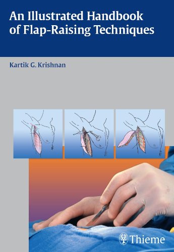 An Illustrated Handbook of Flap-Raising Techniques ✓
