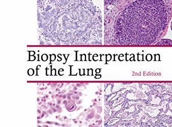 Biopsy Interpretation of the Lung (Biopsy Interpretation Series) 2nd Edition