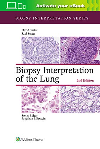 Biopsy Interpretation of the Lung (Biopsy Interpretation Series) 2nd Edition by Saul Suster MD (Author), David Suster MD (Author)